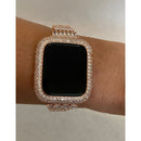 Rose Gold Apple Watch Band Swarovski Crystal Baguettes & or Apple Watch Cover Lab Diamond Bezel Case Smartwatch Bumper Bling 38mm-49mm Ultra